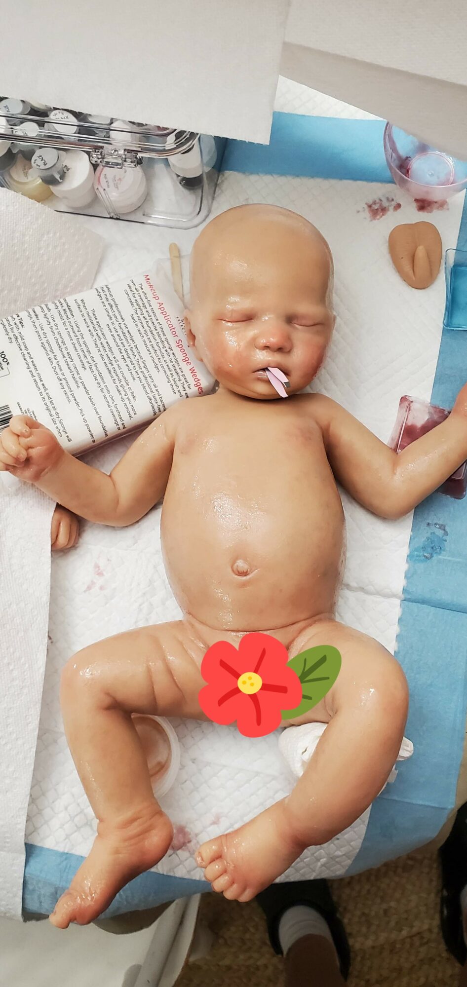 Baby lying on hospital bed with medical supplies nearby, covered with a flower sticker, with a pacifier in mouth.