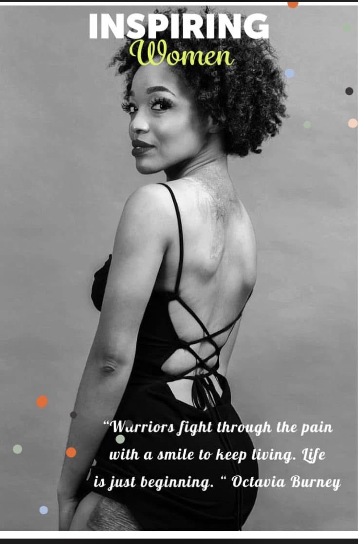 Black and white photo of a woman with curly hair, wearing a backless dress with crisscross straps, looking over her shoulder.