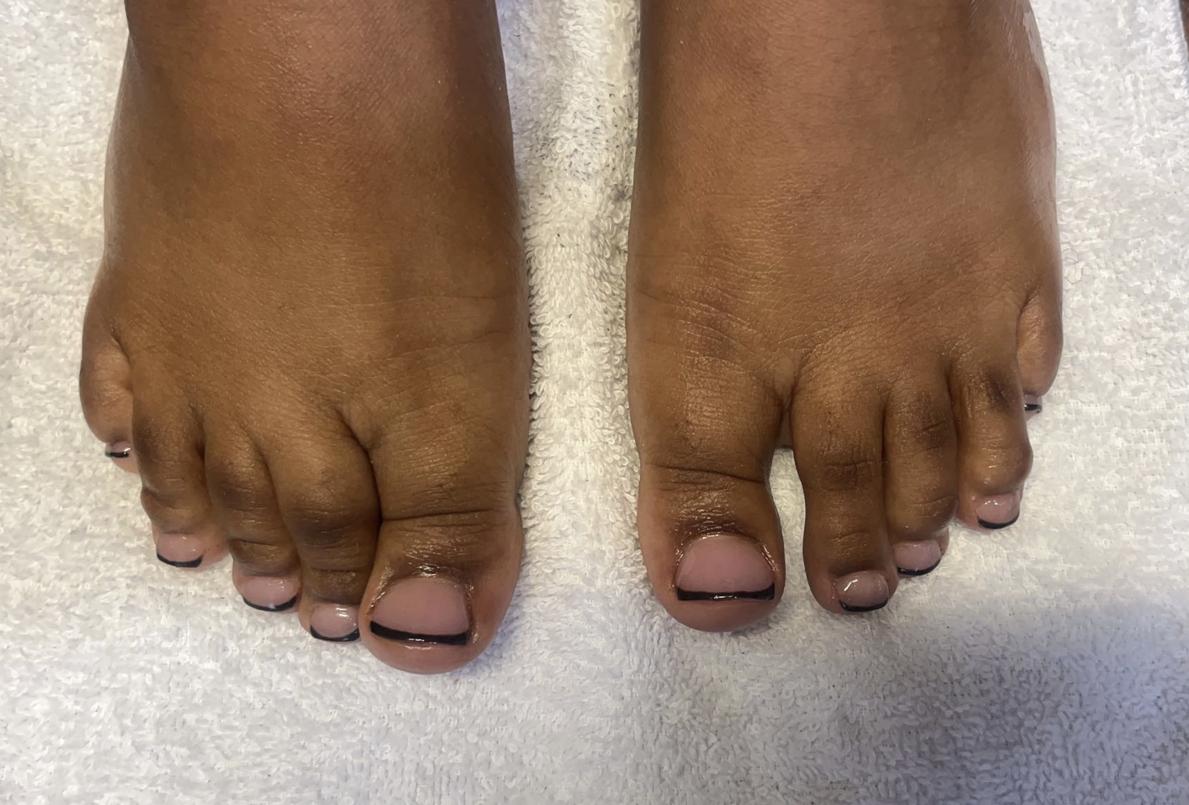Two feet with toes and toenails visible, resting on a light-colored surface.