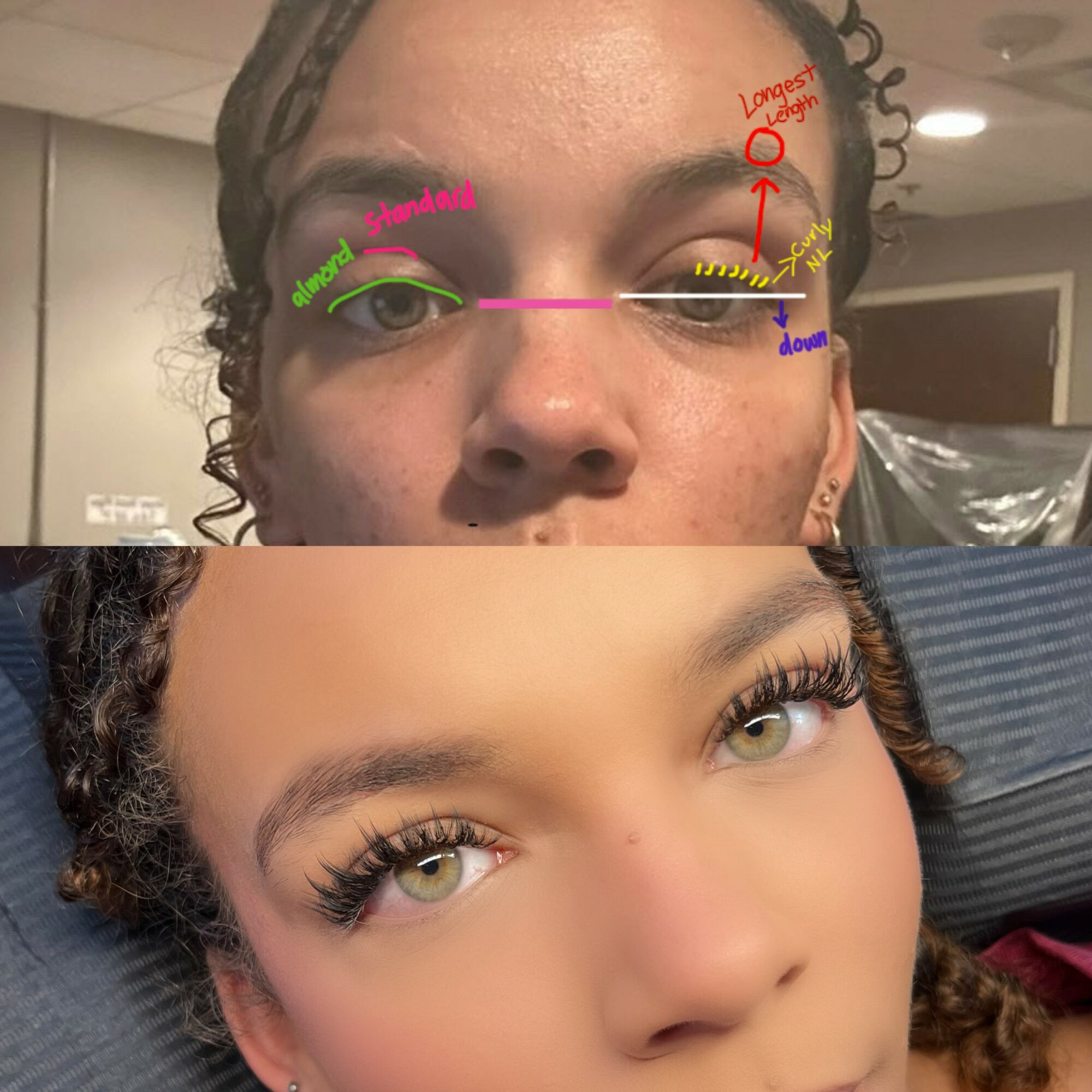 Close-up of two faces, one above the other, with annotations on the upper face's eye area, including labels and arrows.