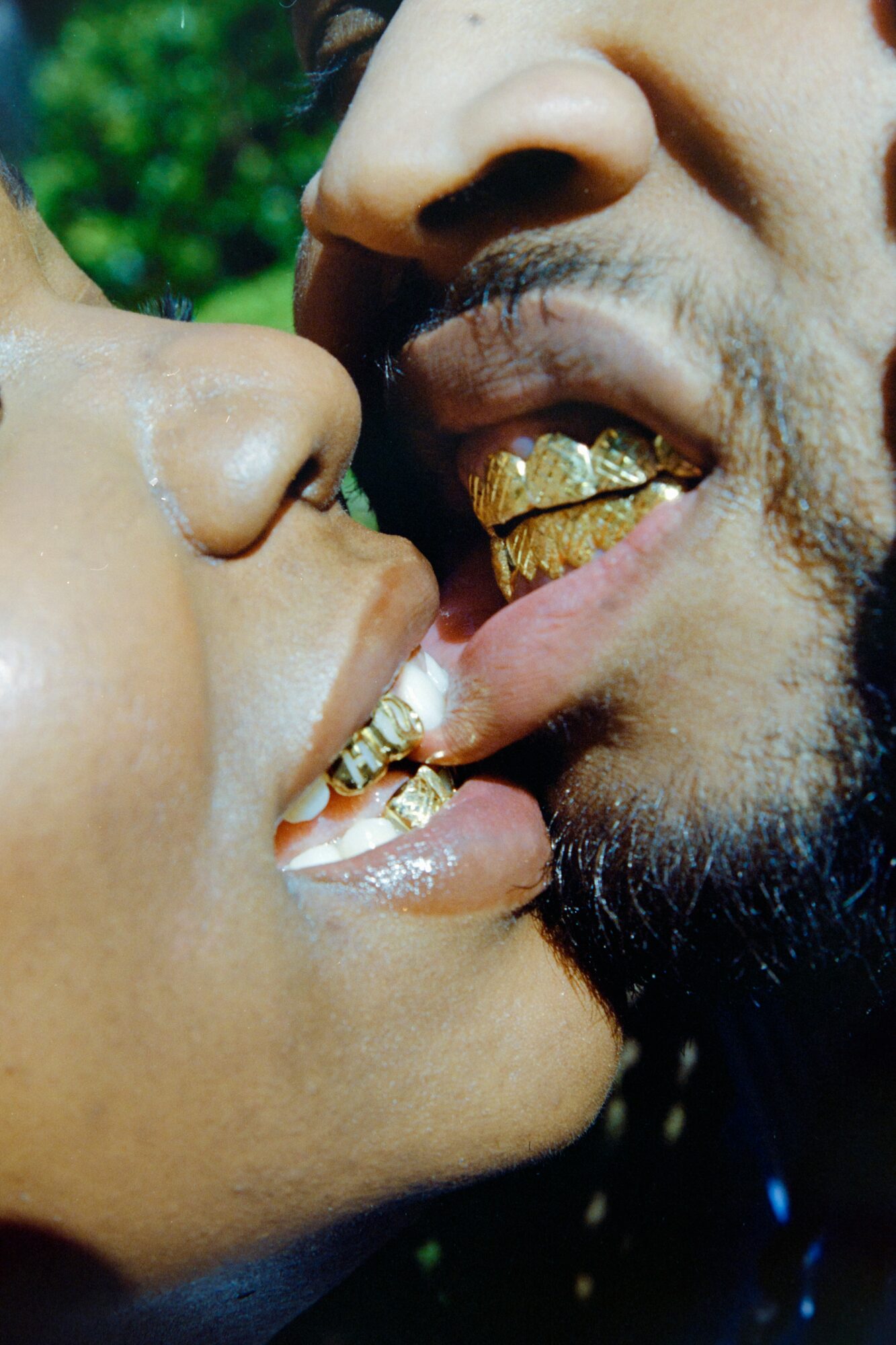 Close-up of two people with gold teeth, their faces close together, outdoors with greenery in background.